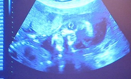 Human Rights Commission